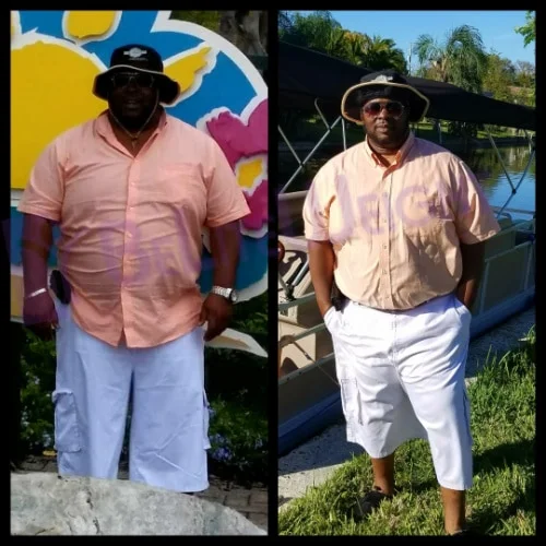Happy patient - 4 Year Update*
